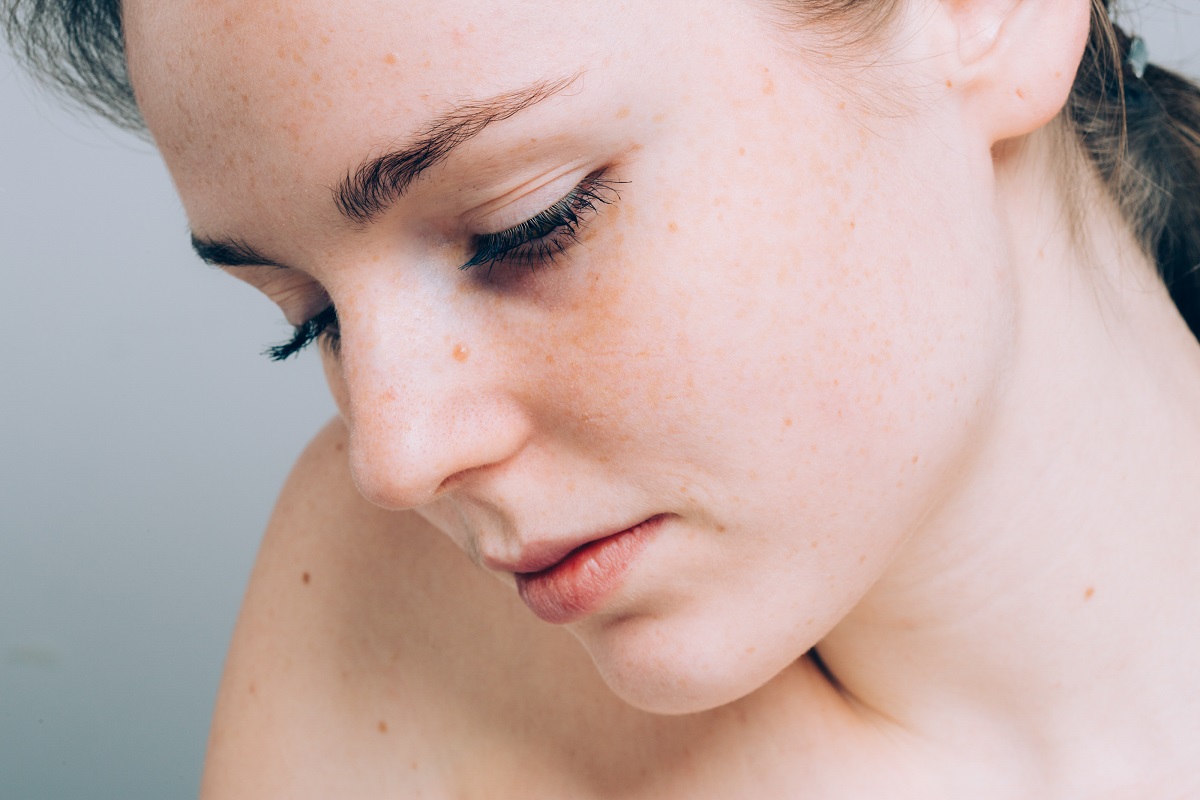 Skóra wrażliwa, czyli jaka?